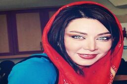 قیافه فقیهه سلطانی قبل از بازیگر شدن و جراحی زیبایی | فقیهه سلطانی چی بودی چی شدی؟ +عکس