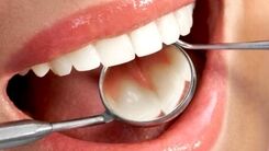 نکات طلایی برای مراقبت از دندان ها