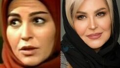 داغون شدن چهره اکرم محمدی بعد از عمل زیبایی +عکس