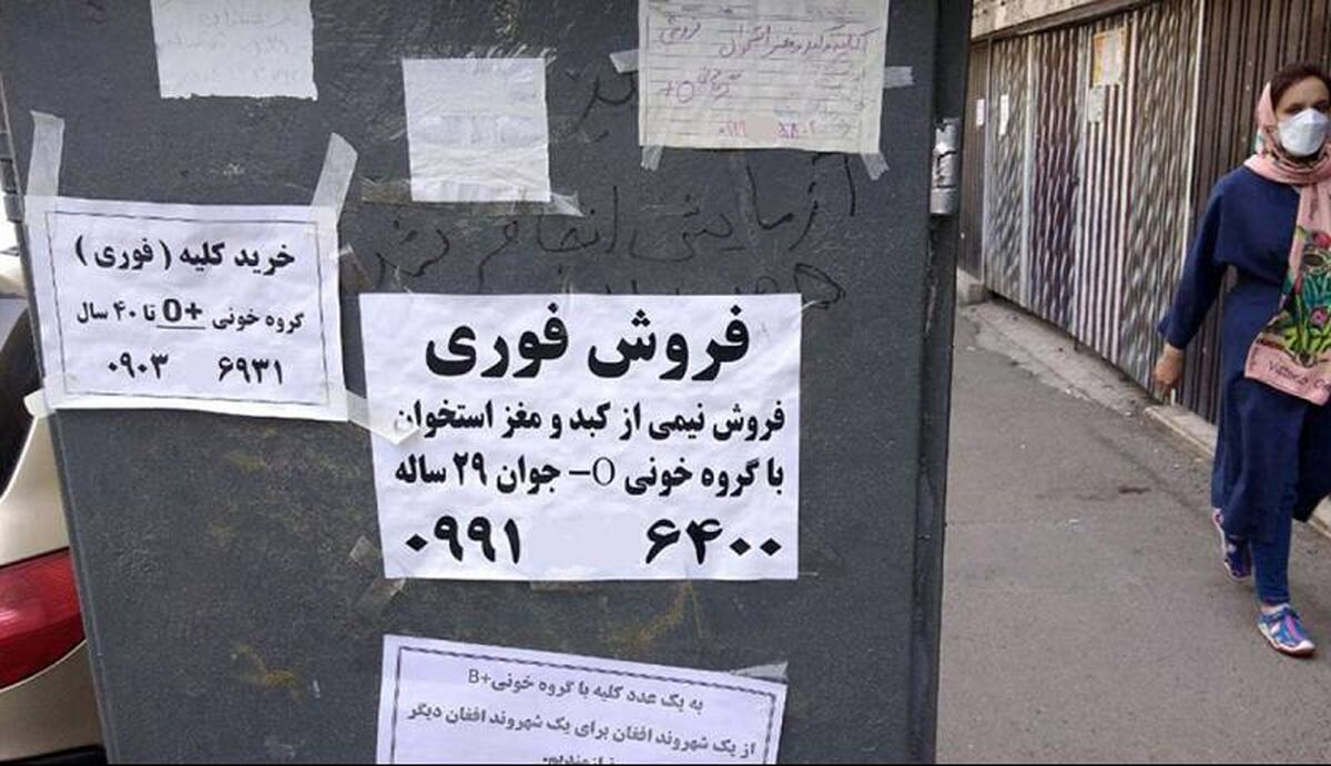 کلیه فروشی در ازای خرید پراید برای مسافرکشی!/دلال‌ها در بازار کلیه ؟