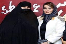 چهره ترسناک الناز حبیبی | بلایی که  خانم بازیگر سر چهره اش آورد + عکس