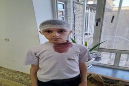 معلم اشنویه‌ای، سر دانش آموز را شکست+عکس