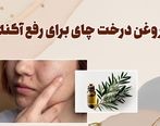 روغن درخت چای برای لک صورت + نحوه استفاده