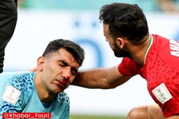  کار علیرضا بیرانوند به جراحی کشید