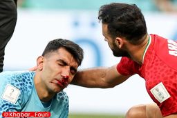  احوالپرسی وزیر از علیرضا بیرانوند | بیرانوند جام جهانی را از دست داد؟ +جدیدترین تصویر