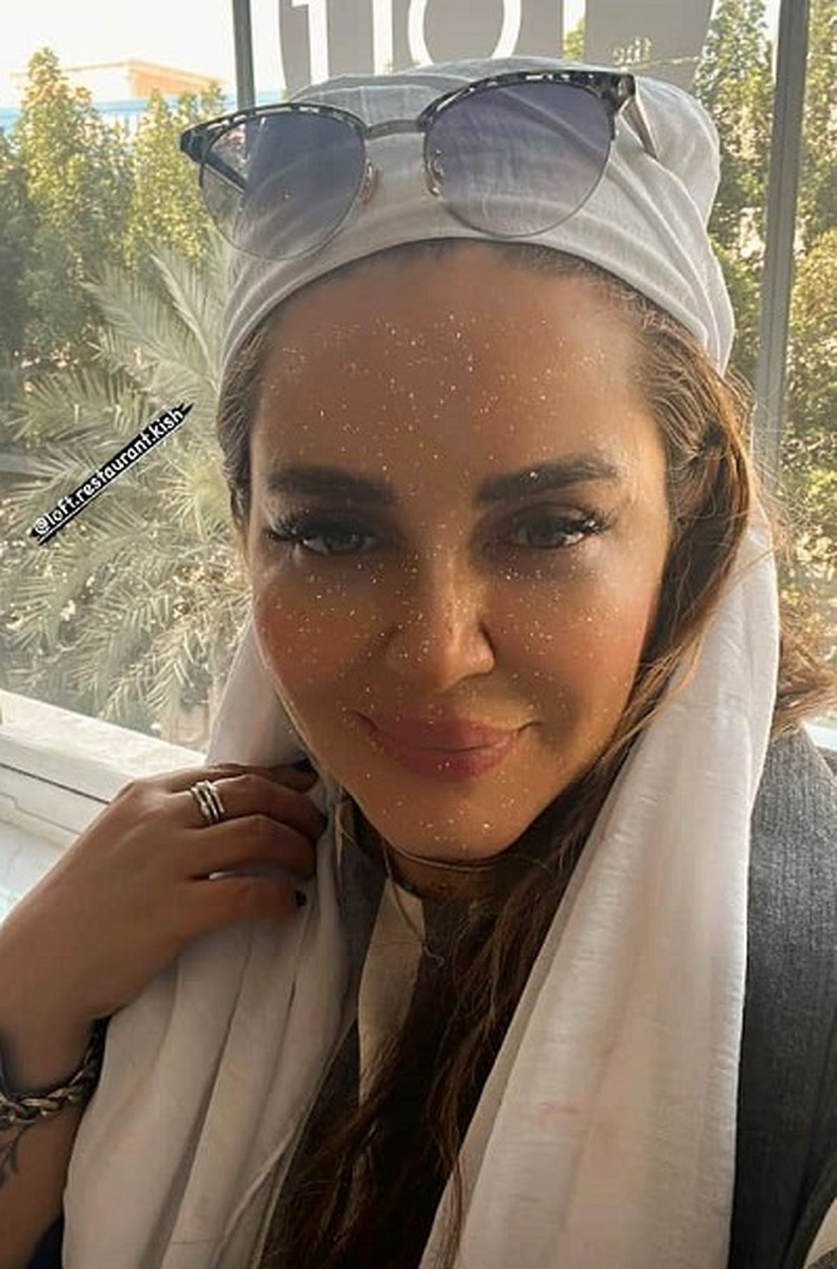 بهاره رهنما برای زیبایی دست به دامن فیلتر های اینستاگرامی شد!/ عمل های زیبایی کافی نبود!+عکس