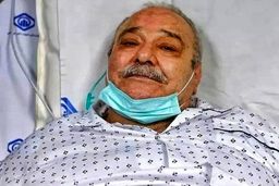 وضعیت وخیم «محمد کاسبی» /عوارض کرونا بازیگر خوش رکاب را راهی آی سی یو کرد