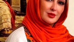 عکس لو رفته از الهام حمیدی قبل و بعد از عمل زیبایی جنجال به پا کرد! | الهام حمیدی از اول کوبیده ساخته! + عکس