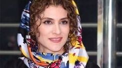 بلایی که دکتر ها سر صورت ویشکا آسایش آوردند | عمل زیبایی ویشکا آسایش برایش دردسر شد ! + عکس جنجالی