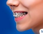 پرداخت اقساطی هزینه انواع خدمات با قسطا کارت