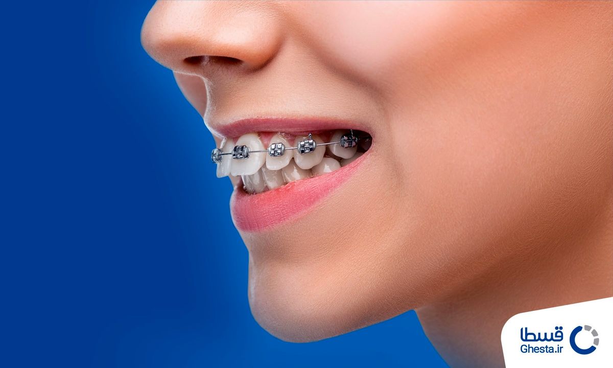 پرداخت اقساطی هزینه انواع خدمات با قسطا کارت