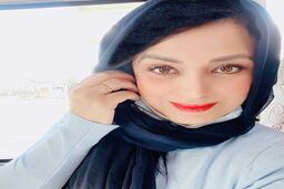 صبا راد هر روز عملی تر از دیروزش | صباراد با عمل زیبایی جدیدش بیست سال جوان تر شد + عکس