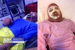 اتفاق وحشتناک برای یک دانشجو در پردیس دانشگاه تهران+عکس