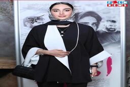 ترلان پروانه رنگ چشمانش را تغییر داد | تغییر رنگ چشم ترلان پروانه همه را خیره کرد