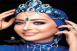 ازدواج دوم به نفیسه روشن ساخت!/با تزریق های زیبایی از بیست سالگیش هم جوانتر شد!+عکس