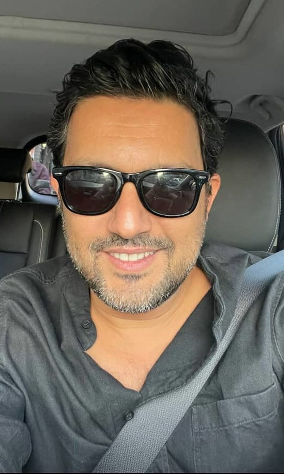 عکس قبل از بازیگری حامد بهداد لو رفت | حامد بهداد برای بازیگر شدن چقدر عمل زیبایی کرده! +عکس