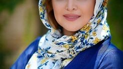 عکس زیرخاکی از جوونی کمند امیر سلیمانی | معلوم نیست چندبار عمل کرده + عکس