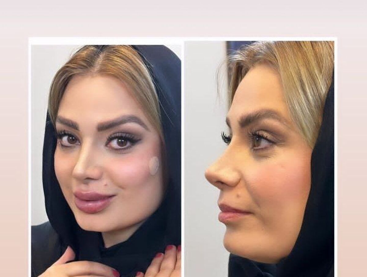 واکنش عجیب مانی رهنما به عمل زیبایی همسرش صبا راد | درگیری صبا راد با همسرش به فضای مجازی کشیده شد +عکس