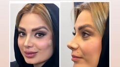 پشیمانی صبا راد بعد از منتشر کردن این عکسش | چهره ترسناک صبا راد بعد از بیرون آمدن از مطب دکتر جراحی زیبایی +عکس