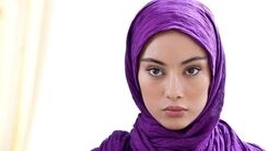 ترلان پروانه معصومیت چهره اش را از دست داد!/عمل های زیبایی خانم بازیگر را زشت کرد!+عکس