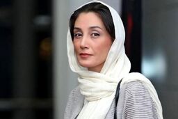 از زیباترین چهره هدیه تهرانی تا چهره داغون خانم بازیگر | خانم بازیگر چی بود چی شد؟