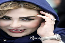 کتک کاری همسر نیوشا ضیغمی او را راهی خیابان کرد | عکس وحشتناک بعد از کتک کاری همسر نیوشا ضیغمی 