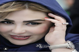 کتک کاری همسر نیوشا ضیغمی او را راهی خیابان کرد | عکس وحشتناک بعد از کتک کاری همسر نیوشا ضیغمی 