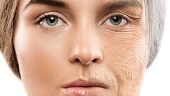شایع ترین عوامل پیری زودرس پوست | چه کار کنیم تا زود پیر نشویم ؟