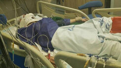 گم شدن جمجمه بیمار تصادفی در بیمارستانی در تهران جنجال به پا کرد |  پسر ۱۴ ساله ضربه مغزی شد بود +عکس