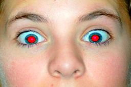 قرمز شدن مردمک چشم در عکس‌ها نشانه چیست ؟ | چشم ها بیمار شده اند ؟