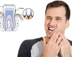 Understanding Teeth Sensitivity: Causes, Symptoms, Treatments, and Prevention