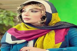 چهره قبلی نیوشا ضیغمی قبل از جراحی زیبایی لو رفت | تفاوت دو عکس نیوشا ضیغمی معجزه عمل زیبایی +عکس 