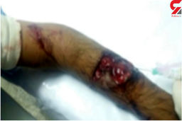 حمله وحشتناک گرگ گرسنه به مرد روستایی+عکس