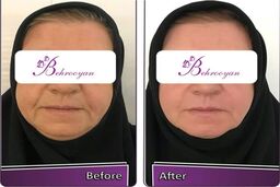 بهرویان معتبرترین کلینیک جراحی زیبایی در تهران  
