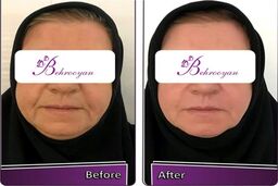 بهرویان معتبرترین کلینیک جراحی زیبایی در تهران  
