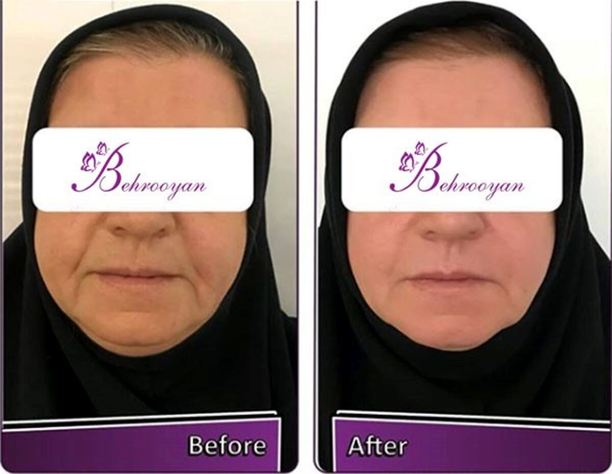 بهرویان معتبرترین کلینیک جراحی زیبایی در تهران  
