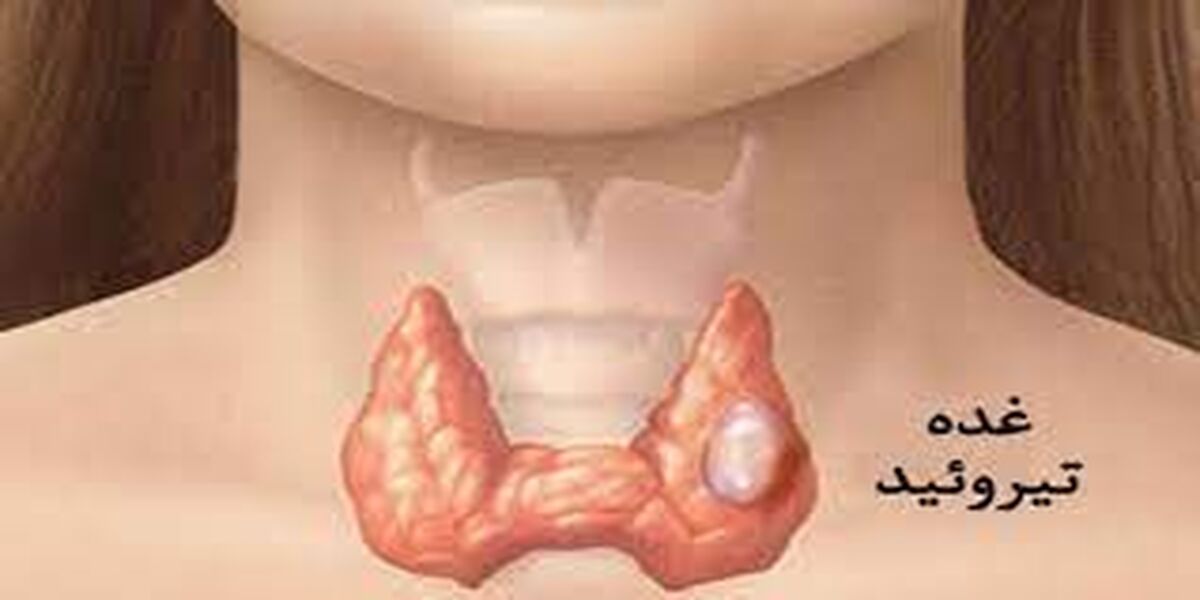 اگر کم کاری تیروئید دارید بخوانید |  بهترین رژیم غذایی برای مبتلایان کم‌کاری تیروئید