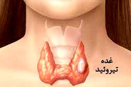 اگر کم کاری تیروئید دارید بخوانید |  بهترین رژیم غذایی برای مبتلایان کم‌کاری تیروئید