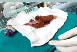 حمله زن کارتن خواب به پرستار اورژانس /تصویر هولناک از پرستار در اتاق عمل +عکس