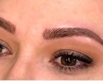 کاشت ابرو برای چه کسانی مناسب است؟ چه عوارضی دارد؟