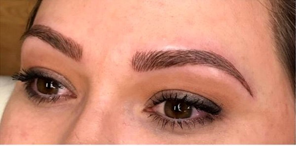 کاشت ابرو برای چه کسانی مناسب است؟ چه عوارضی دارد؟