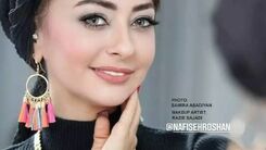 کتک خوردن وحشتناک نفیسه روشن از شوهر جدیدش/ ماجرای شکایت سلبریتی پرحاشیه از آقای خلبان+عکس