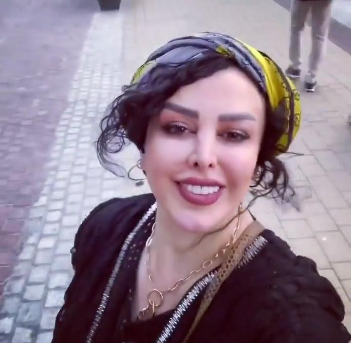 تغییر چهره باورنکردنی فلور نظری با عمل زیبایی جدید /خانم بازیگر شبیه سحرتبر شد +عکس شوکه کننده